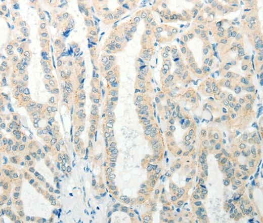 RAB25 Polyclonal Antibody (E-AB-12234)