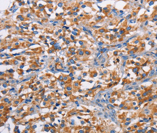 PIM2 Polyclonal Antibody (E-AB-10916)
