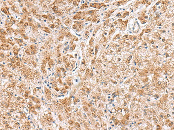 HMGCLL1 Polyclonal Antibody (E-AB-18988)