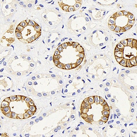 AQP3 Polyclonal Antibody (E-AB-70279)