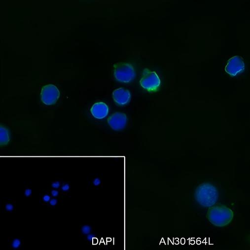 Recombinant IL-12 Monoclonal Antibody (AN301564L)