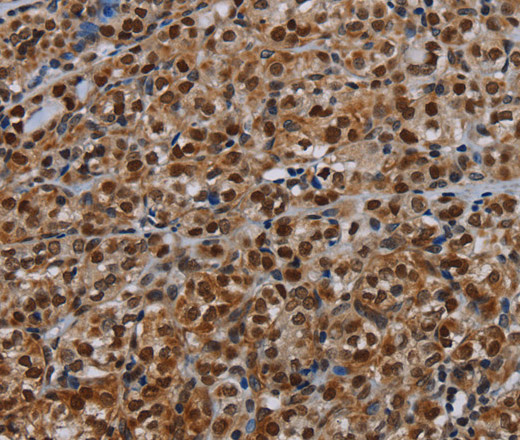 DCAF6 Polyclonal Antibody (E-AB-13470)