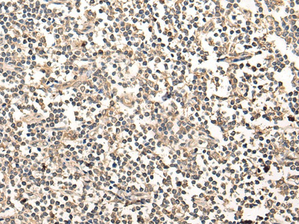 MAGEA1 Polyclonal Antibody (E-AB-19419)