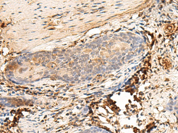 HLA-DQB1 Polyclonal Antibody (E-AB-52722)