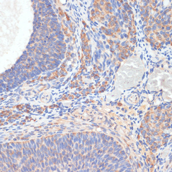 TES Polyclonal Antibody (E-AB-67822)