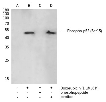 Recombinant Phospho-p53 (Ser15) Monoclonal Antibody (AN300367L)