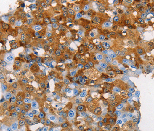 MUC5B Polyclonal Antibody (E-AB-15988)