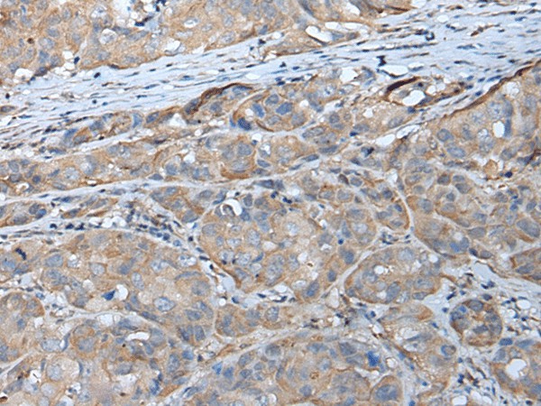 GPC5 Polyclonal Antibody (E-AB-53437)