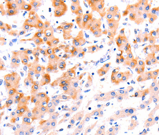 Ephrin A1 Polyclonal Antibody (E-AB-10303)
