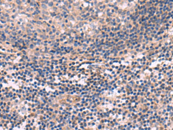 KCNT1 Polyclonal Antibody (E-AB-52085)