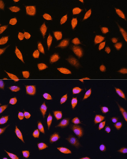 PNPO Polyclonal Antibody (E-AB-67361)
