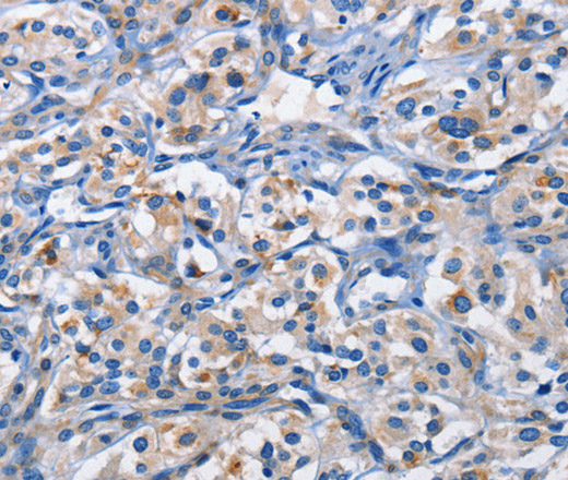 PIM1 Polyclonal Antibody (E-AB-14694)