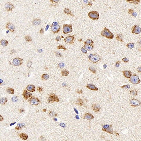 DCX Polyclonal Antibody (E-AB-70186)