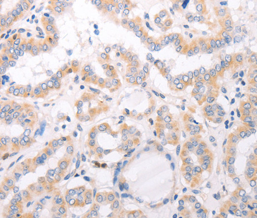 CIDEB Polyclonal Antibody (E-AB-14428)