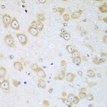 ACOX1 Polyclonal Antibody (E-AB-62608)