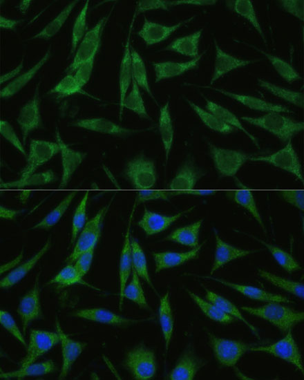 RHBDD1 Polyclonal Antibody (E-AB-64986)