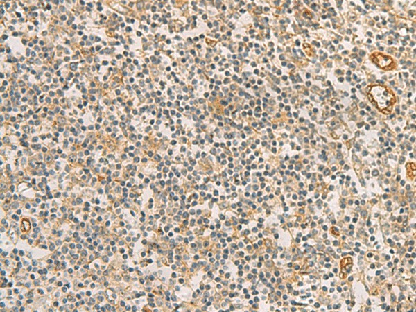 RAB13 Polyclonal Antibody (E-AB-19166)