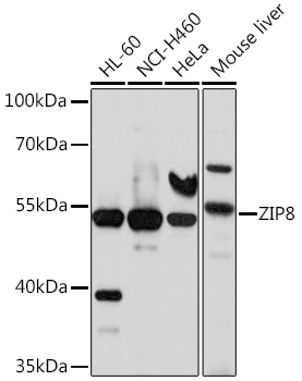ZIP8 Polyclonal Antibody (E-AB-90151)