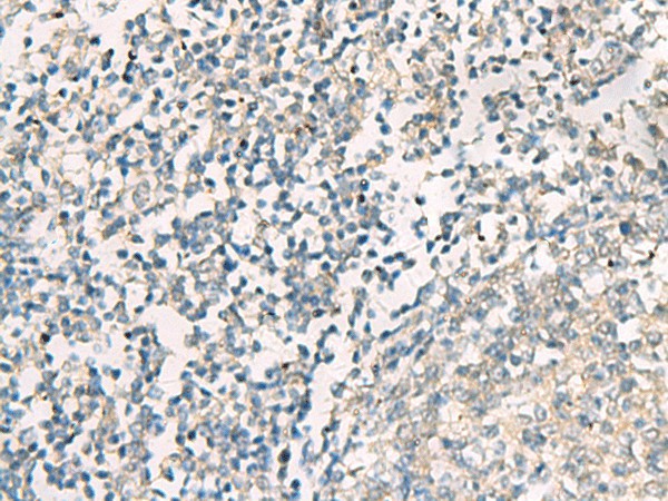 SERPINB4 Polyclonal Antibody (E-AB-52213)
