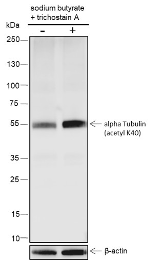 Recombinant alpha Tubulin (Acetyl K40) Monoclonal Antibody (AN301410L)