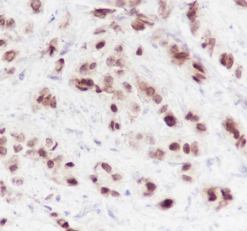 Recombinant FOXA1 Monoclonal Antibody (AN301525L)