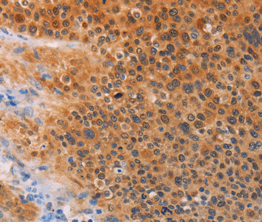 ADHFE1 Polyclonal Antibody (E-AB-12956)