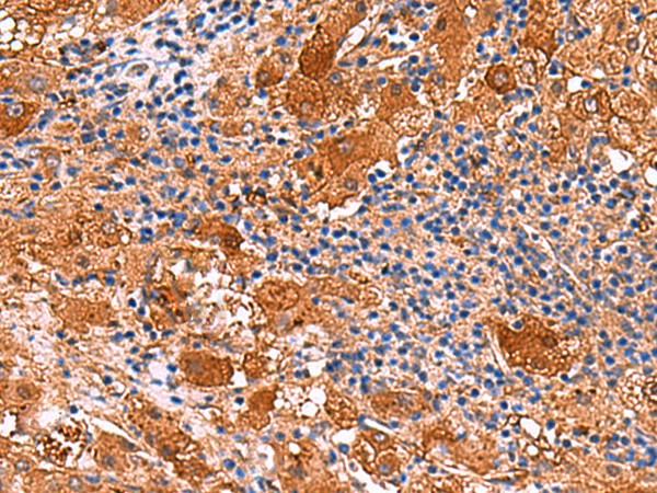 KANK3 Polyclonal Antibody (E-AB-18153)