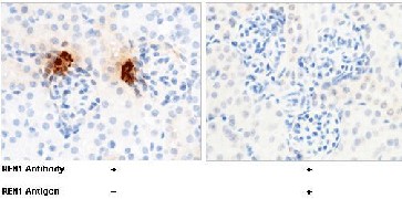 Recombinant REN1/Renin-1 Monoclonal Antibody (AN300502P)
