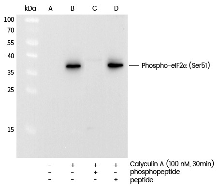 Recombinant Phospho-eIF2α (Ser51) Monoclonal Antibody (AN300145L)