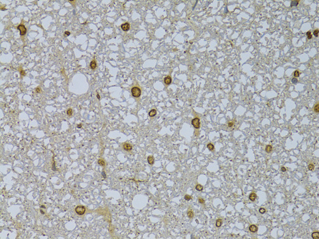 HDGFRP3 Polyclonal Antibody (E-AB-63908)