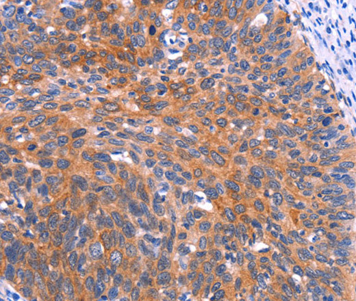 PTPN13 Polyclonal Antibody (E-AB-13236)