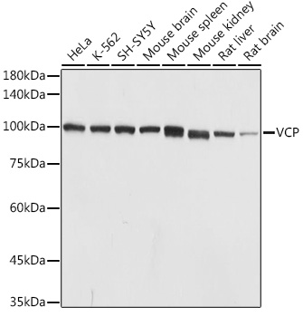 VCP Polyclonal Antibody (E-AB-92494)