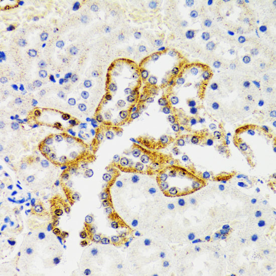 SH2B1 Polyclonal Antibody (E-AB-61018)