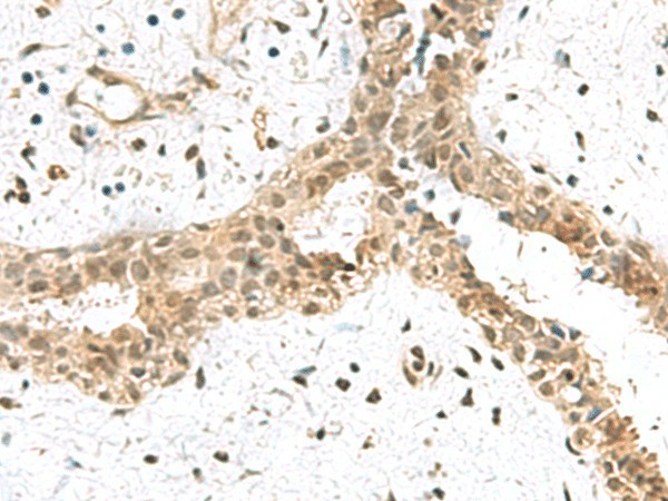 ELOC Polyclonal Antibody (E-AB-19103)