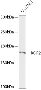 ROR2 Polyclonal Antibody (E-AB-61029)