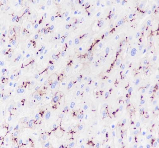 Recombinant ABCB11/BSEP Monoclonal Antibody (AN301450L)