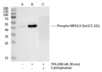 Recombinant Phospho-MEK1/2 (Ser217, 2210) Monoclonal Antibody (AN300366L)