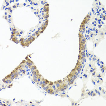 TTR Polyclonal Antibody (E-AB-60194)