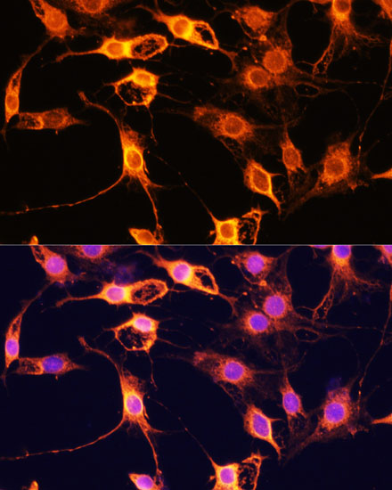 TRAF6 Polyclonal Antibody (E-AB-67008)