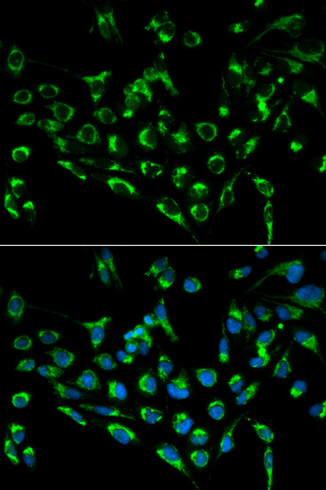 CDKN3 Polyclonal Antibody (E-AB-60584)