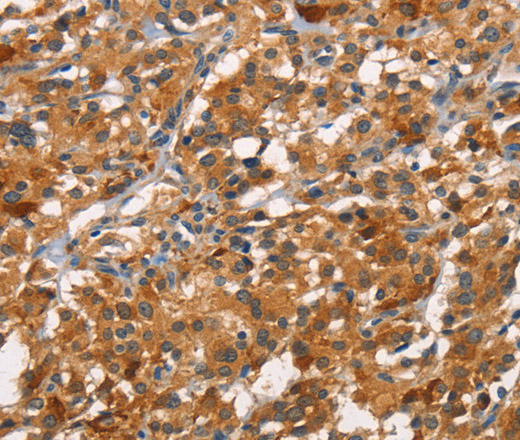 CDC25B Polyclonal Antibody (E-AB-12785)
