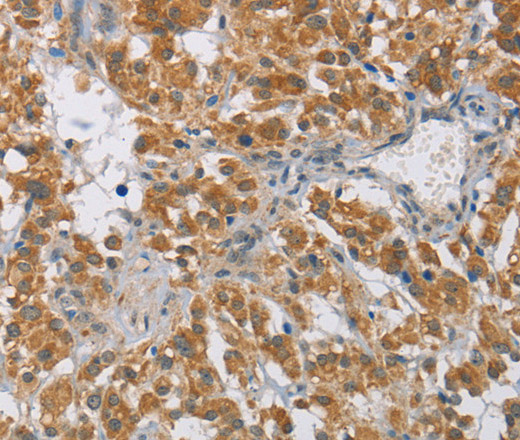 DIO1 Polyclonal Antibody (E-AB-11137)