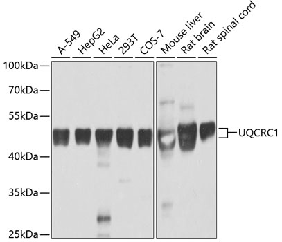 UQCRC1 Polyclonal Antibody (E-AB-62257)