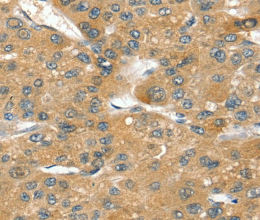 SORT1 Polyclonal Antibody (E-AB-16874)