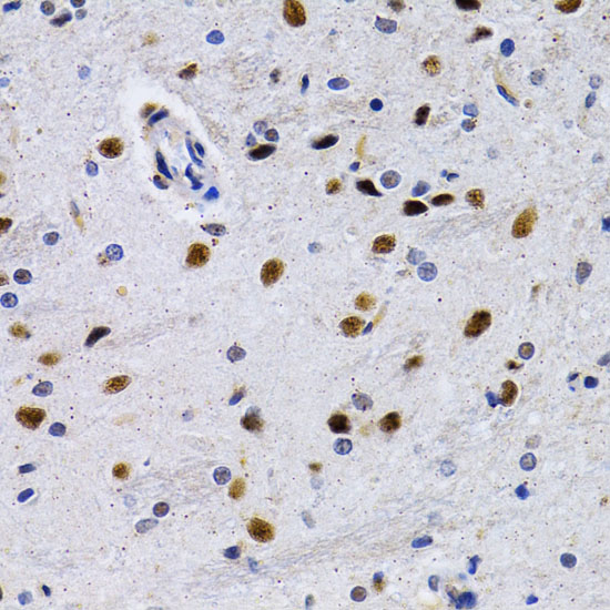 ID3 Polyclonal Antibody (E-AB-61795)