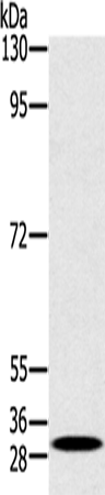 RAB27A Polyclonal Antibody (E-AB-15324)