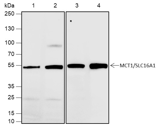 Recombinant SLC16A1 Monoclonal Antibody (AN301937L)