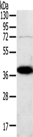 SPARC Polyclonal Antibody (E-AB-14366)