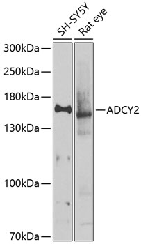 ADCY2 Polyclonal Antibody (E-AB-92988)