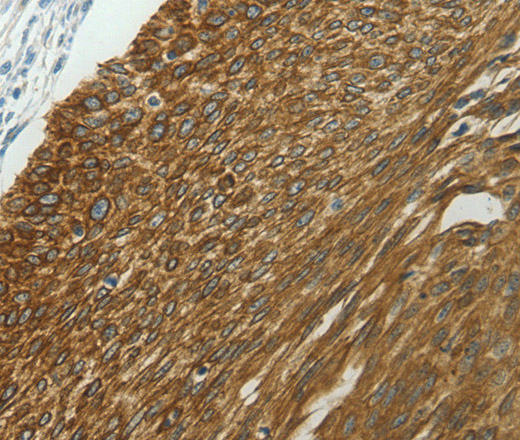 NDRG2 Polyclonal Antibody (E-AB-15994)